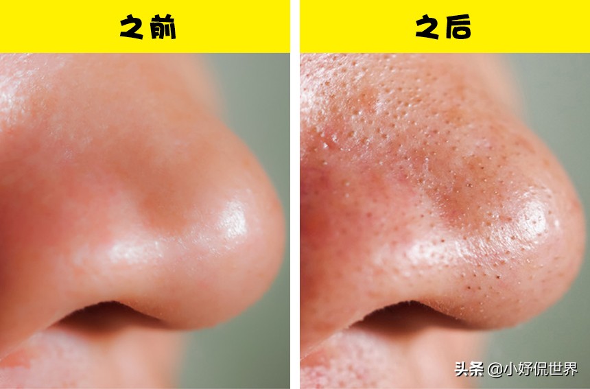 化妆湿巾有什么好处,经常用湿巾的危害