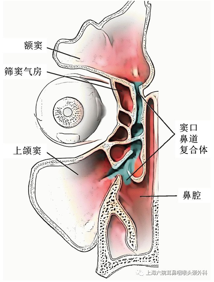 上颌窦炎穿刺手术全过程,上颌窦炎一般小门诊能治疗吗