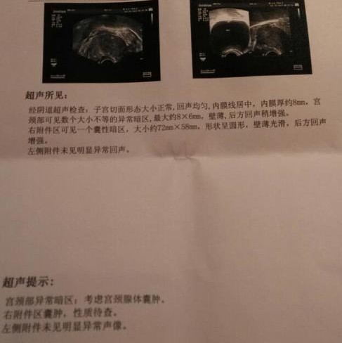 我检查出来有卵巢囊肿问题严重吗,最近检查肝有囊肿我好烦咋办