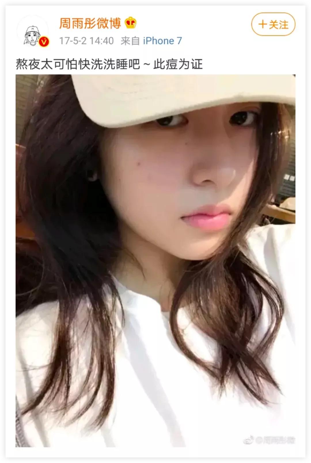 每到换季就会爆痘,换季时爆痘