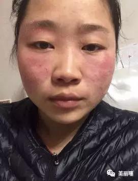 315被曝光的护肤品,广州315曝光的化妆品