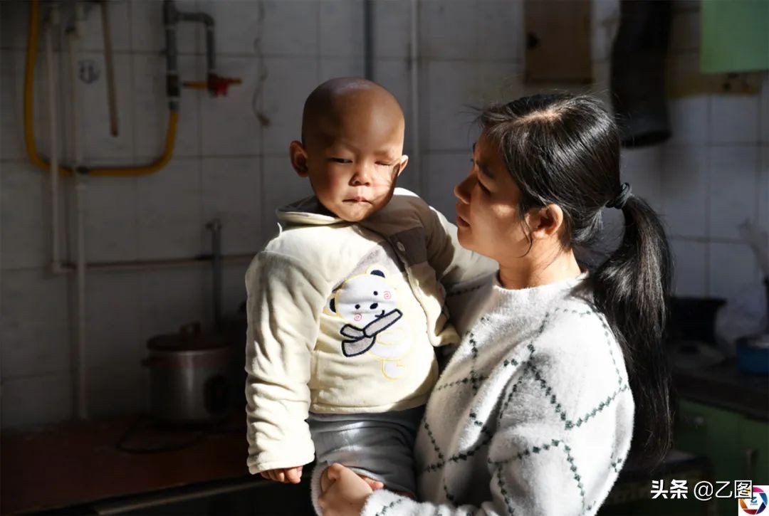 世上最悲催的婴儿,人间悲惨的孩子