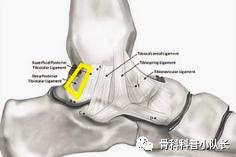 刚崴脚是要冷敷还是热敷,崴脚后24小时内是热敷还是冷敷