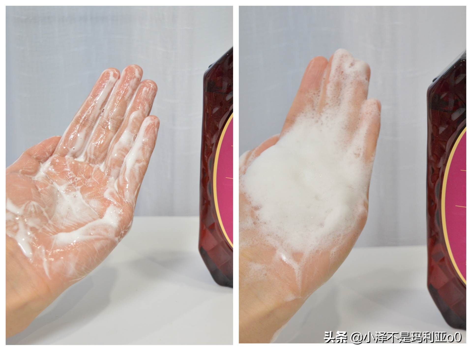 额头秃发际线后移适合什么洗发水,拯救发际线的洗发水