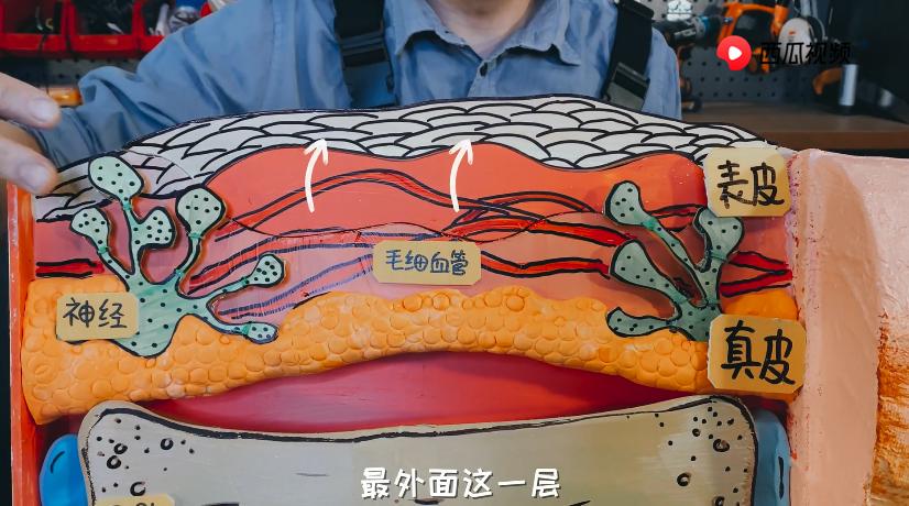 深二度烫伤和浅二度烫伤对比图片,烫伤的泡变暗红色