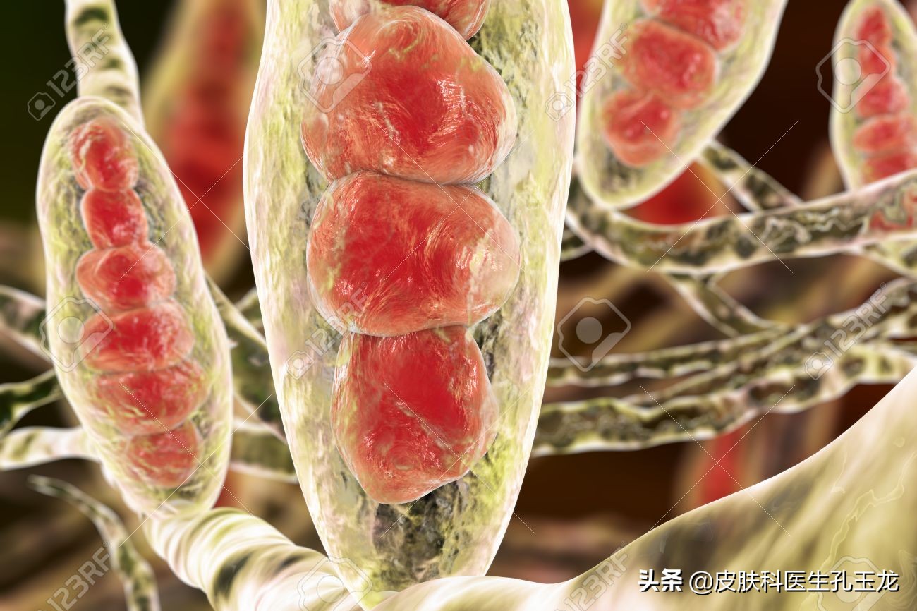 医院皮肤科医生治脚气用什么药,皮肤科医生脚气脚臭怎么办