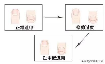 日本专用指甲刀自带放大镜,日本指甲刀带放大镜原装进口