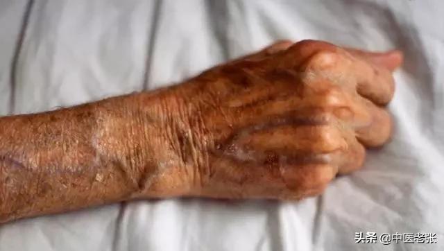 老人身上为什么总有股老人味,老人身上的老人味是怎么形成的