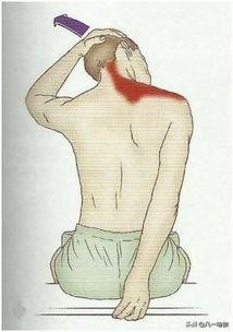 一个溜肩一个直角肩怎么改善,一边是直角肩一边是溜肩怎么改善