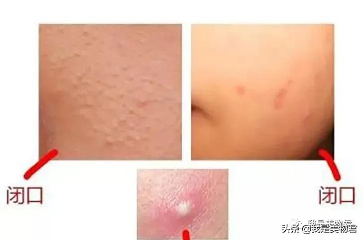 最近最火的茄子面膜,茄子面膜好用吗