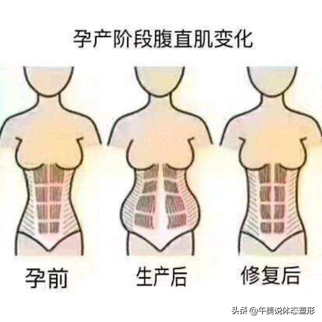 宝妈小腹突出怎么锻炼,宝妈肚子怎么练都紧致