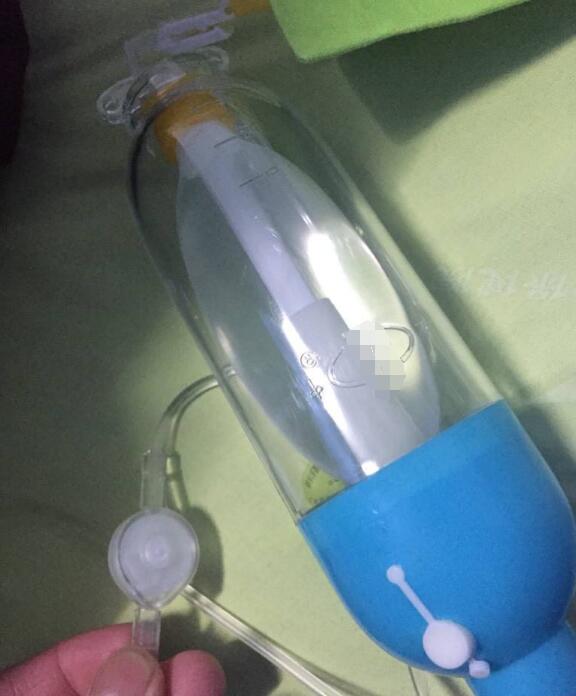 剖腹产后用镇痛泵有效果吗,剖腹产后用镇痛泵还是很痛