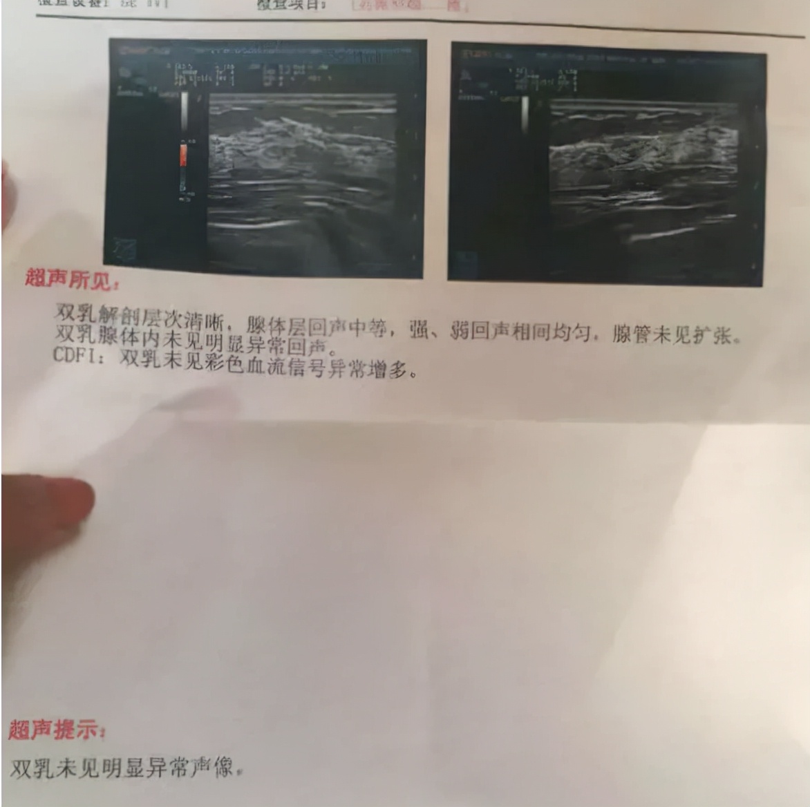 乳房结节怎么手术切除,乳房结节切除是立即病理确诊吗