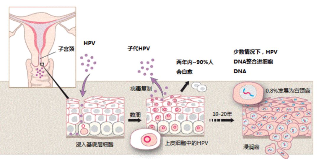 宫颈癌双筛的报告解读,宫颈癌最深度解读