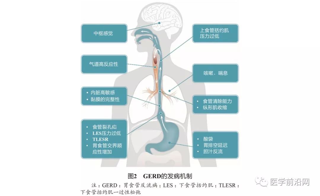 胃食管反流病误诊急性冠脉综合征,胃食管反流性咽炎会引起咳嗽吗