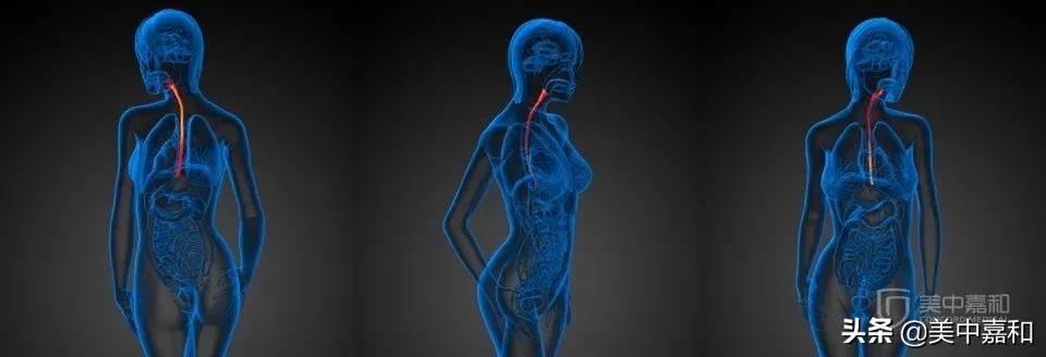 有关ct的检查,跟大家聊聊ct的危害