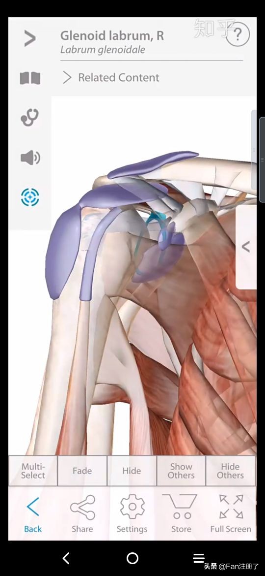 肩痛肩袖损伤针刀治疗,肩痛肩关节活动受限用什么药