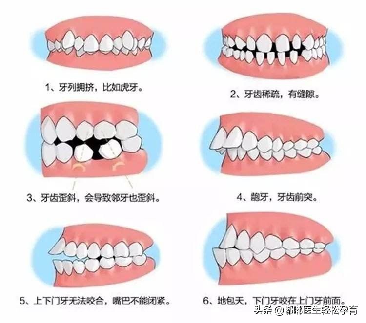 宝宝爱吃手会导致细菌感染吗,宝宝爱吃手要如何纠正