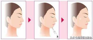 好看的下巴有哪些,好看的下巴