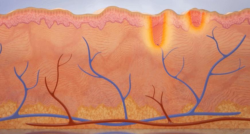 毛孔粗大要开始改善该怎样做,毛孔粗大不可逆别慌还有救