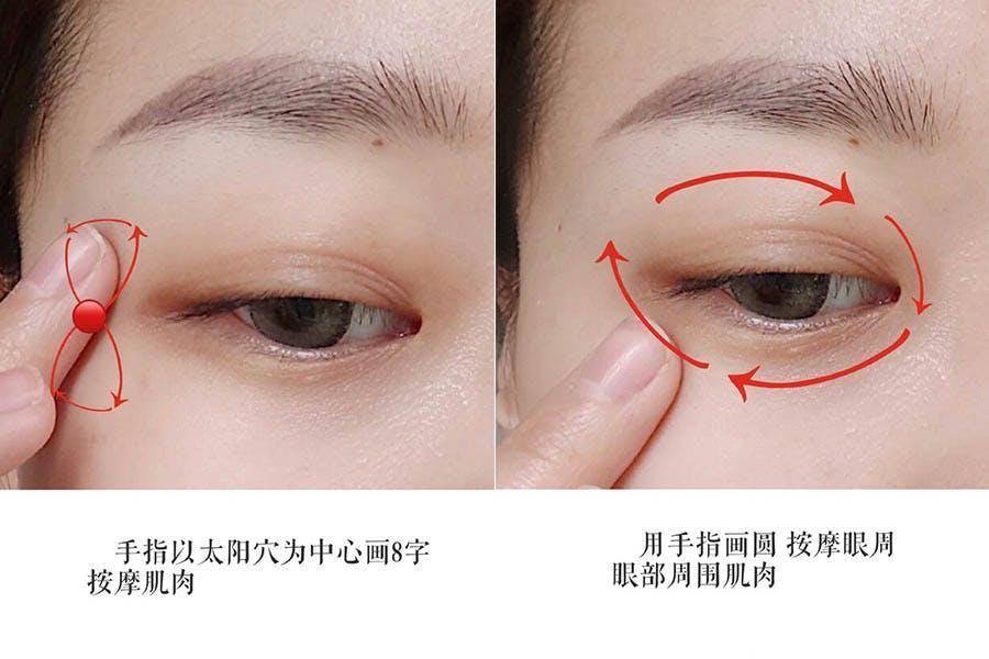 如何有效改善眼周水肿,眼水肿了怎么消肿