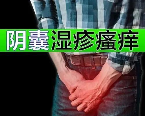 阴囊湿疹的3大表现症状!一旦出现,立即就医