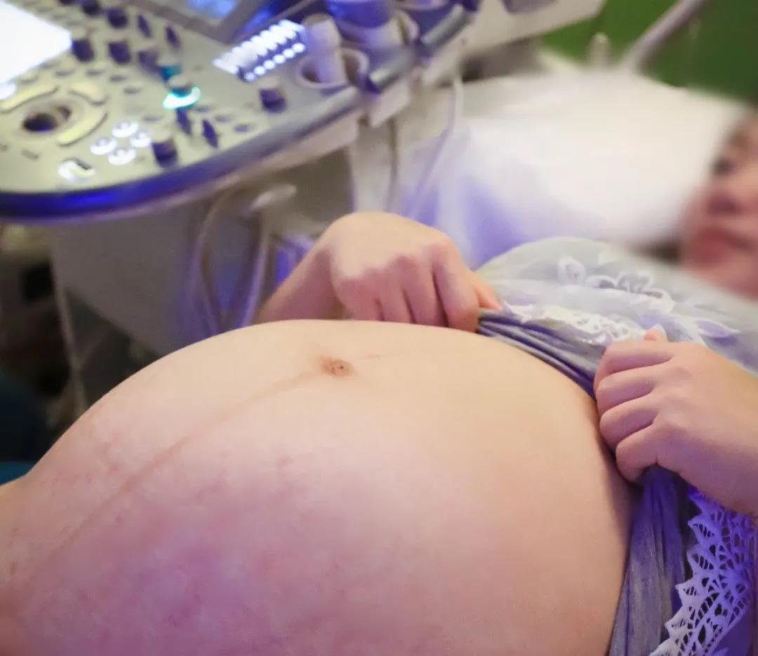 孕期检查做几次四维彩超,孕期产检需要做几次肝胆彩超