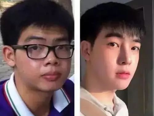 泰国最逆天的不是变性，而是堪比换头的整形