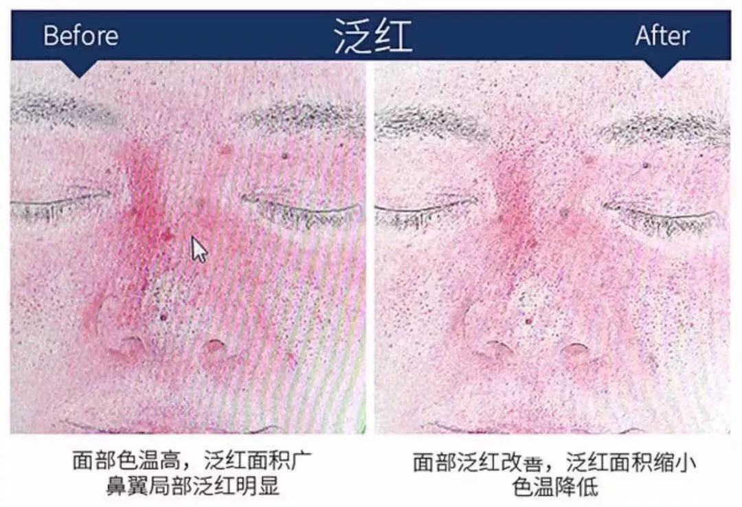 赵露思推荐补水保湿,赵露思推荐水感保湿焕颜面霜
