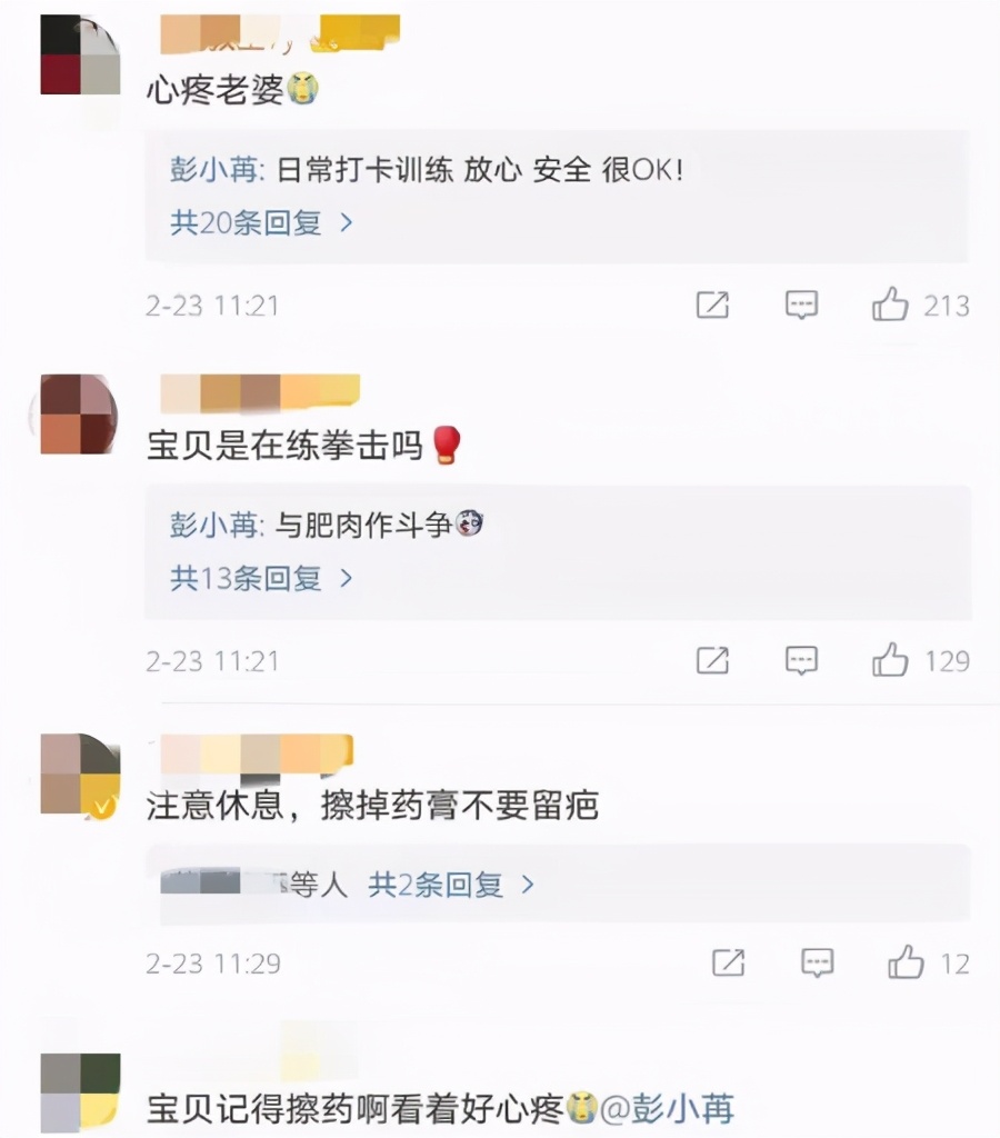 太心疼!30岁女星为减肥练拳击,双手受伤破皮,淤青严重恐留疤