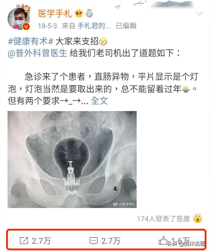 一条罗非鱼“游”进肛门？医生：直肠不直，进去容易出来难