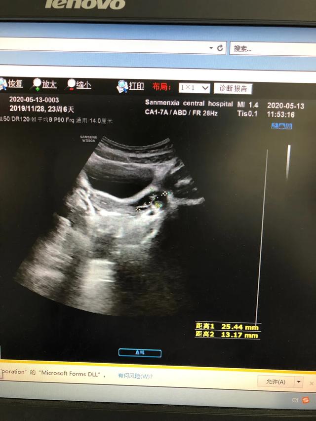 儿童性早熟要做哪些检查？怎么根据这些指标判断真性还是假性？