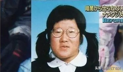 石原里美和佐藤健,石原里美整容之路