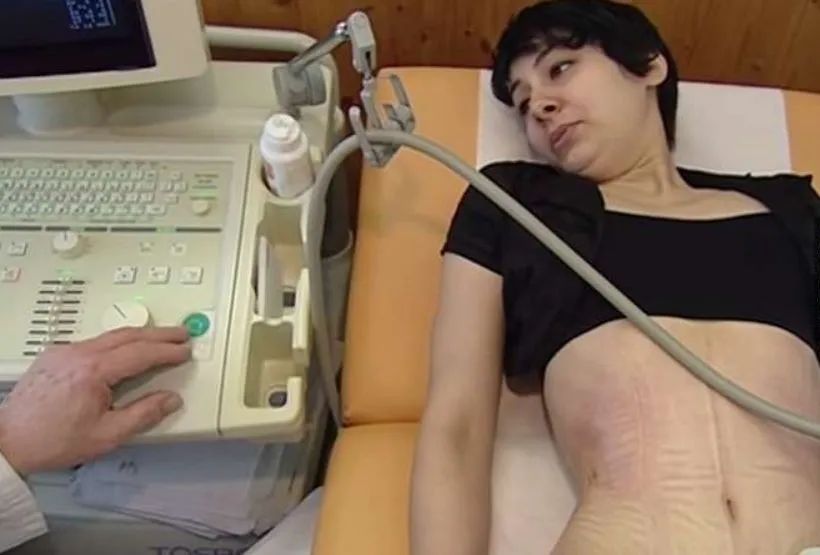 没生过孩子束腰会导致漏尿吗,产后戴束腰会导致漏尿吗