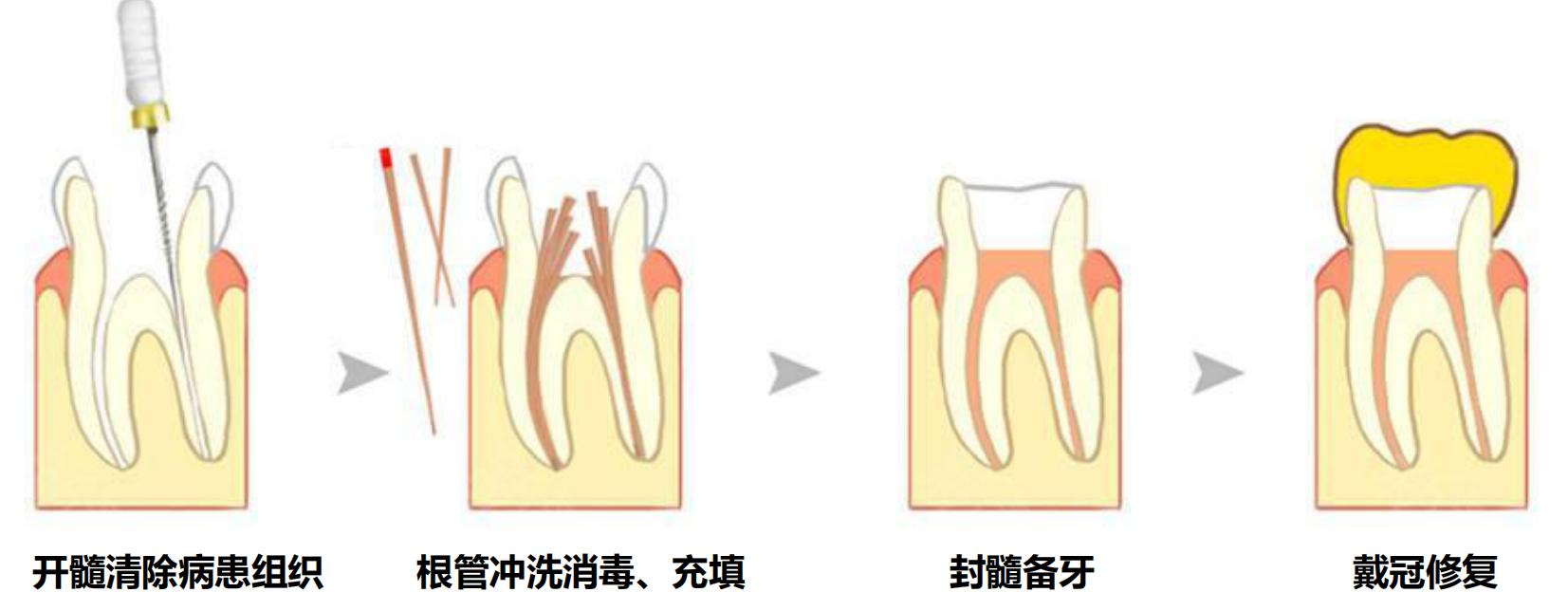关于开口腔门诊的知识,带您一分钟了解诊所