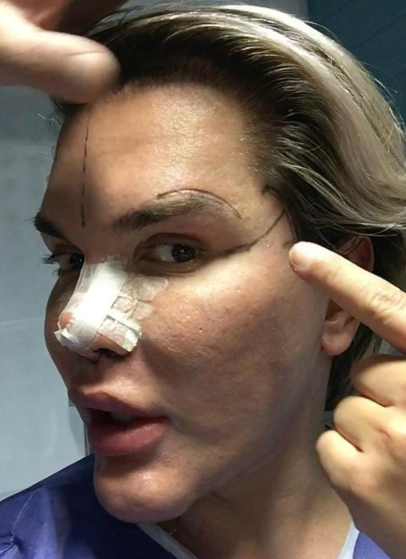 巴西男芭比娃娃,巴西整容狂人芭比娃娃