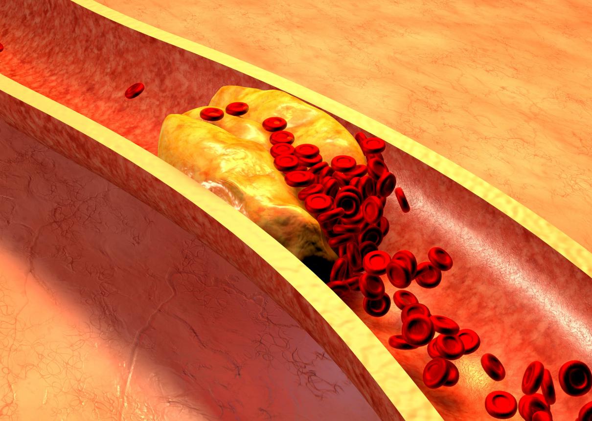 养生保健的放血疗法,老人一年花20万在养生馆放血排毒