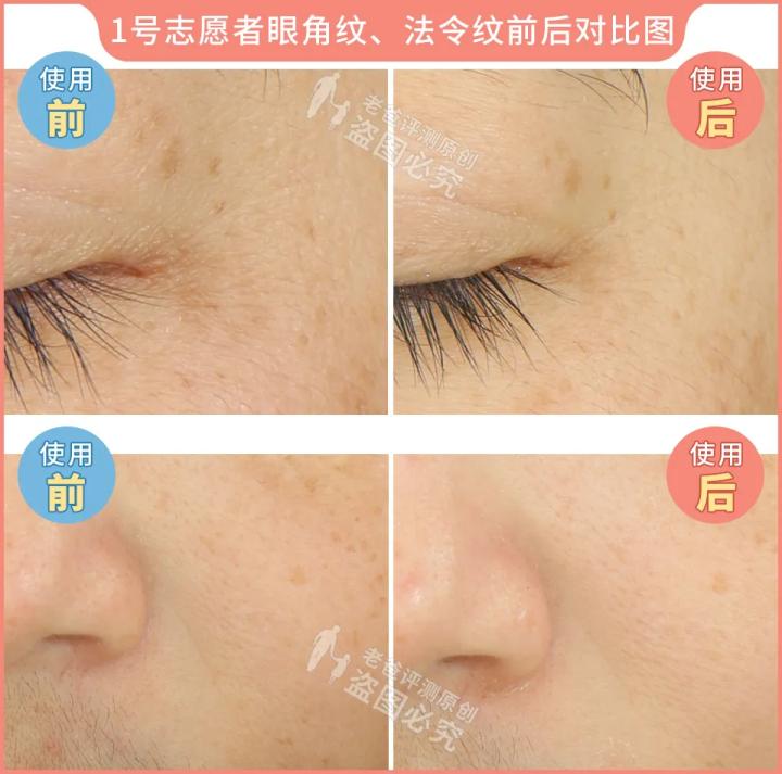 300块的网红美容仪有效果吗,网红家用美容仪测评