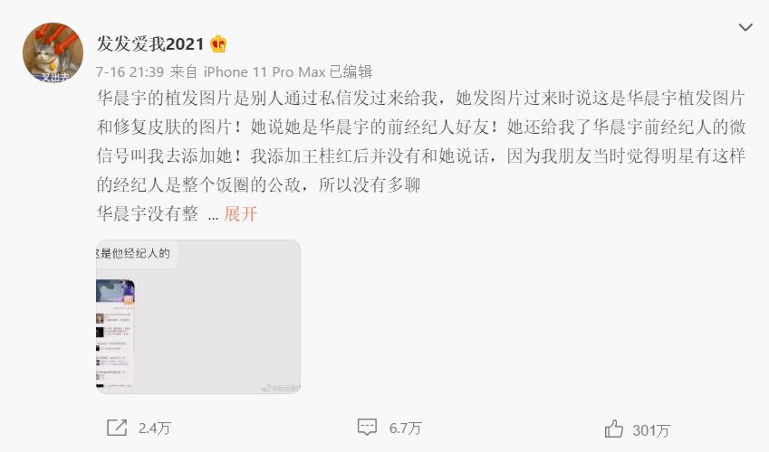 “单纯”人设翻车？华晨宇被曝整容植发，未来口碑又该何去何从？