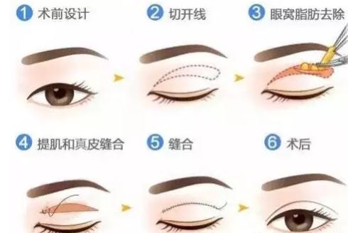 香港最后一个美少女,她被誉为香港最后一位美人