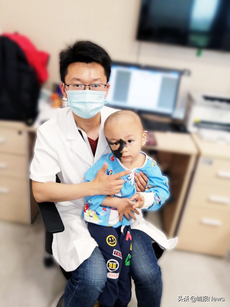 “巨痣”症男童有望告别“熊猫脸”