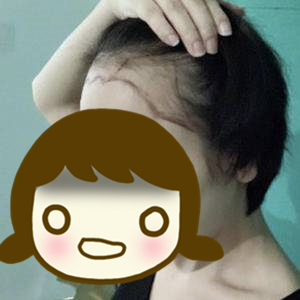 发际线太高怎么办,发际线太高怎么办做什么发型