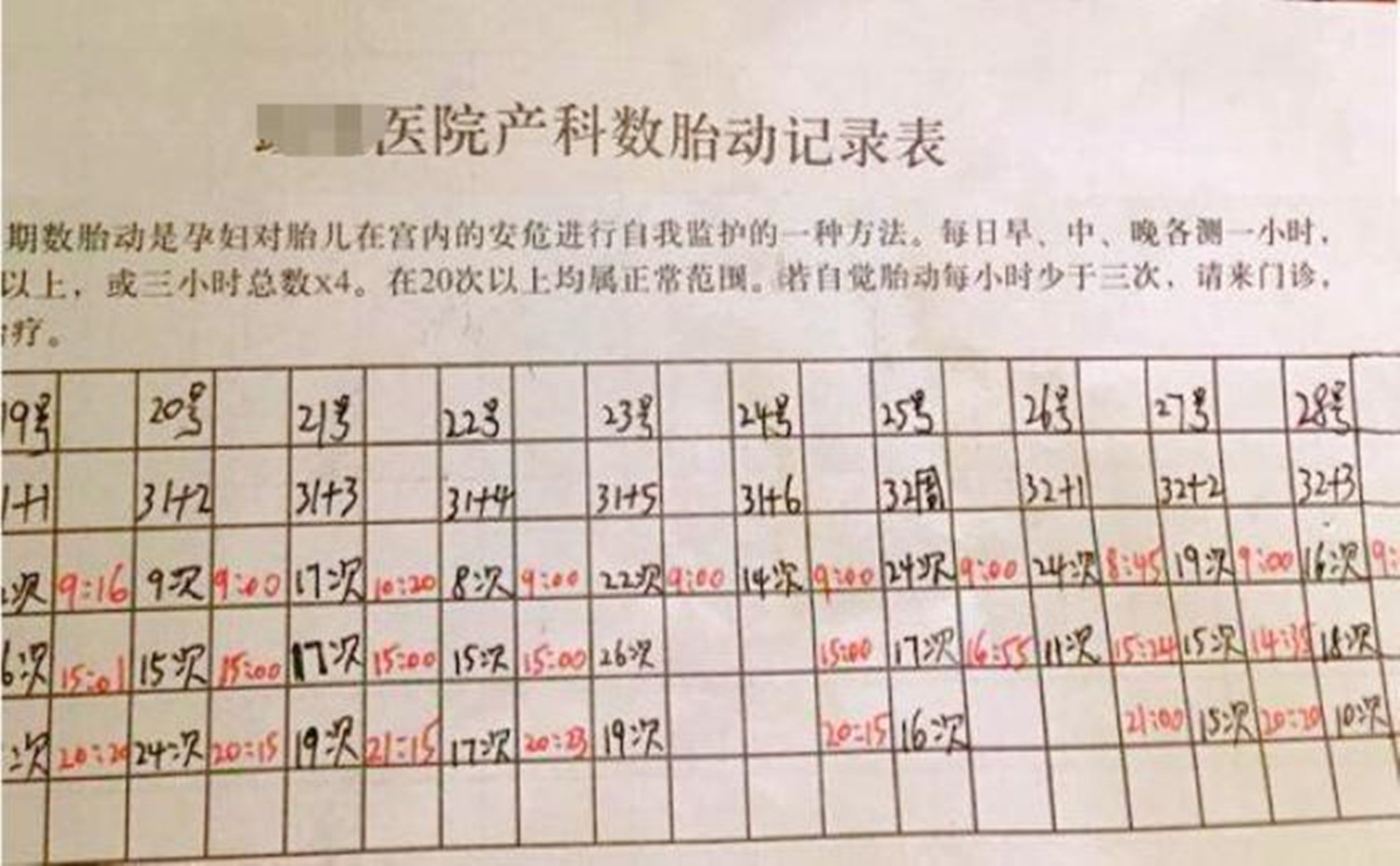 胎动频繁时怎么数胎动,胎动规律是怎么样的