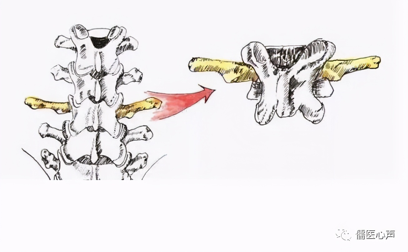 腰部往里凹了经常疼,腰部往上一点脊柱两侧疼痛的原因