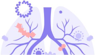 戴口罩时眼镜起雾的解决方法,眼镜起雾戴口罩怎么办