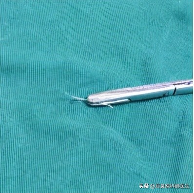 为啥来院就做内镜检查?医生怕是在骗我钱吧