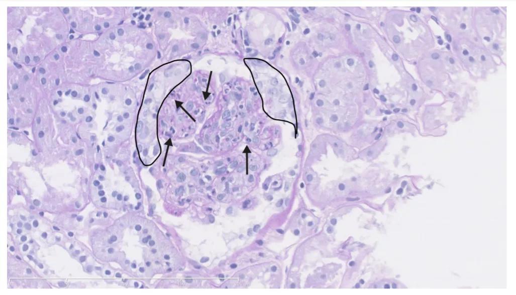 男童大腿两侧出现了红疹,小男孩腿两边长疹子怎么用药