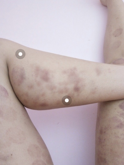 瘦萝卜腿的方法简单,夏季拯救大粗腿的食物