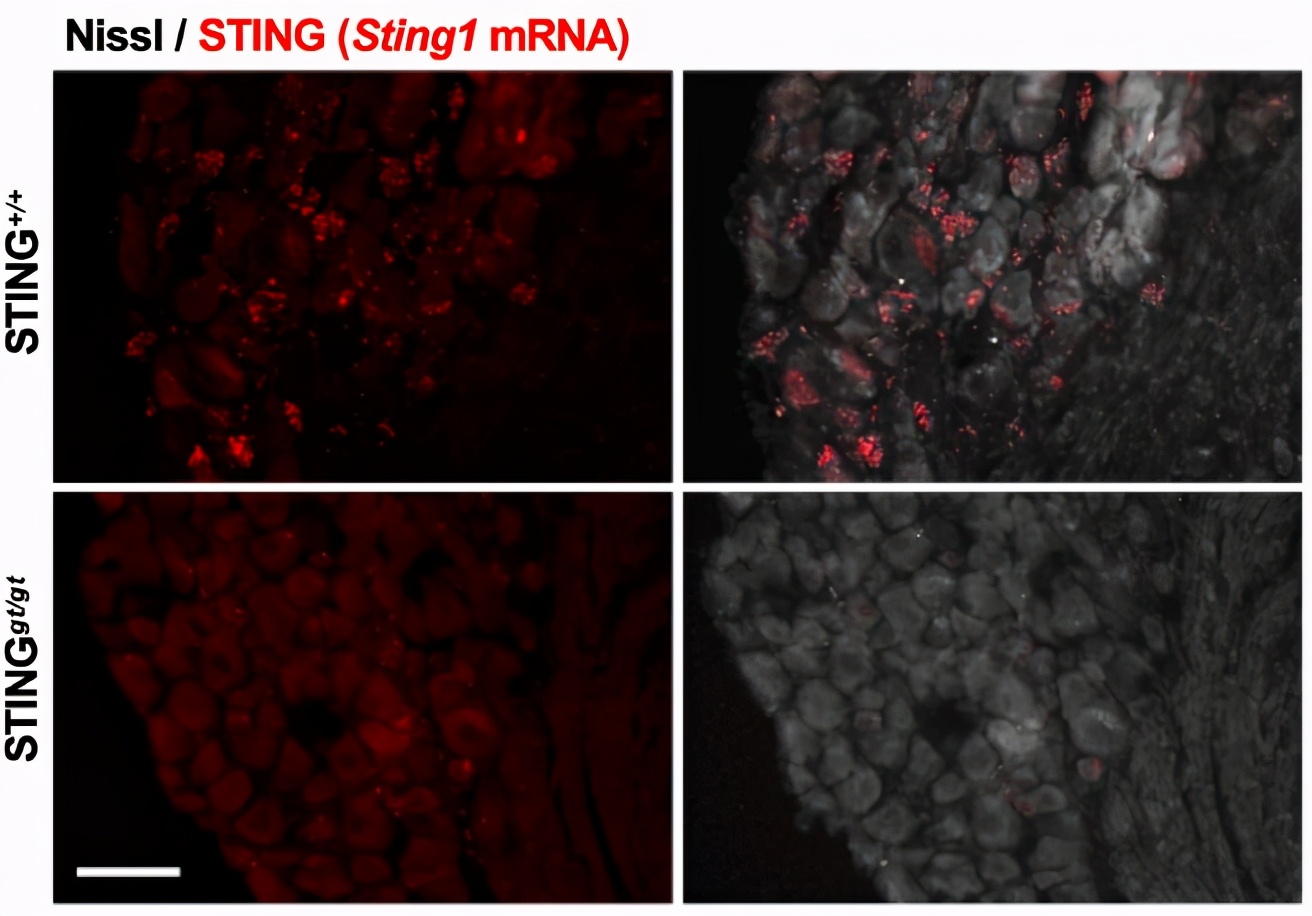 腰酸背痛吃点补品,腰酸背痛喝中药有效果吗