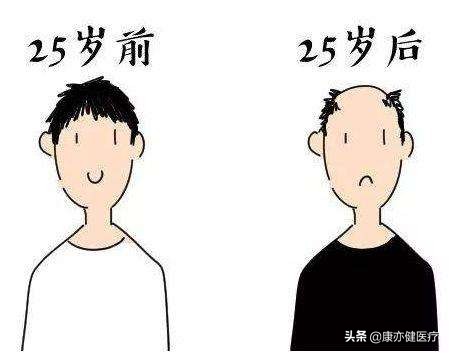 “十大脱发因素”，你中招了吗？